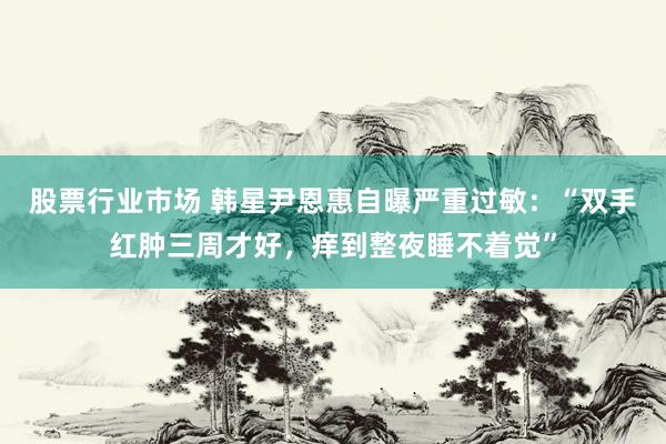 股票行业市场 韩星尹恩惠自曝严重过敏：“双手红肿三周才好，痒到整夜睡不着觉”